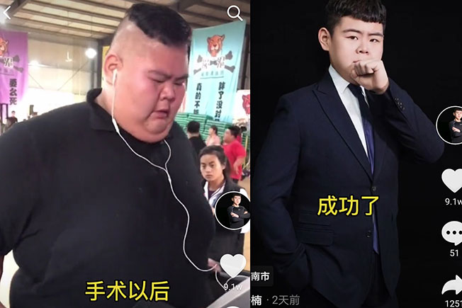 减肥前后的王浩楠。