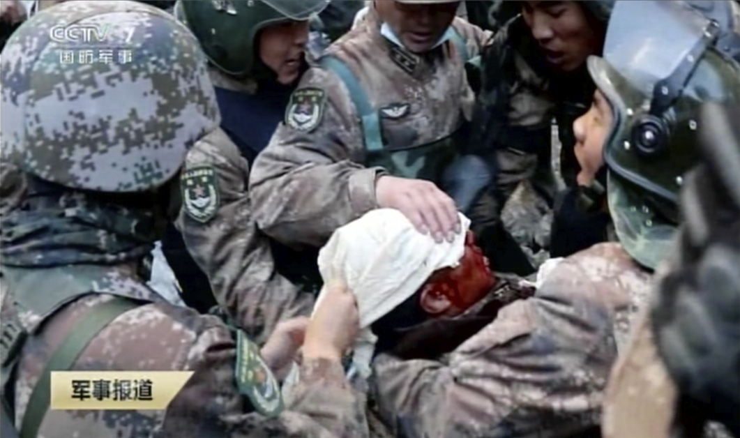 一名解放军头部受伤浴血，同僚给予救援。（美联社）