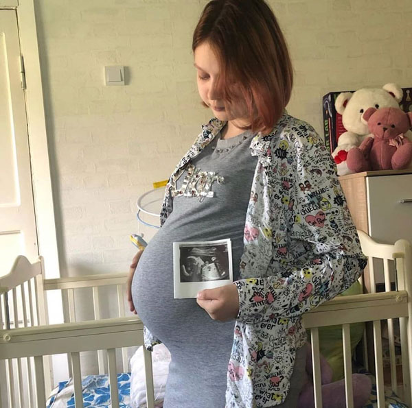 戴利亚两年前被家人发现怀孕，事后她称经手人是其10岁男友，震惊俄罗斯社会。