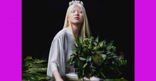 中国白化病少女雪丽 成为模特儿登上Vogue杂志