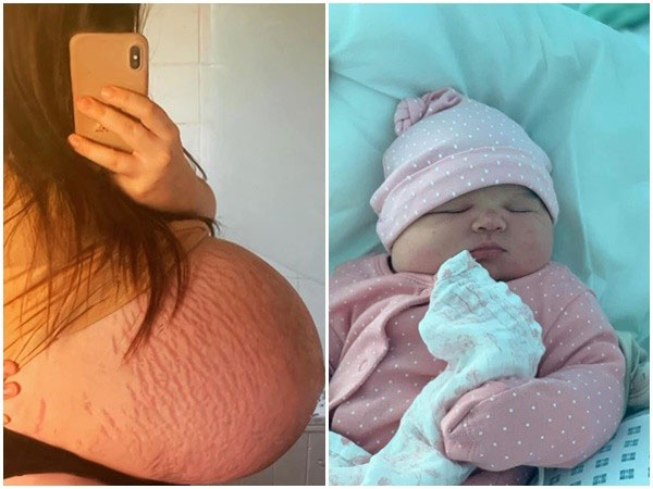 英国新手妈妈生下近6公斤的巨婴。