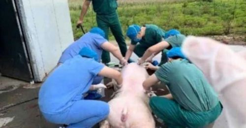 男子全身96％灼伤 医护现场杀猪剥皮移植