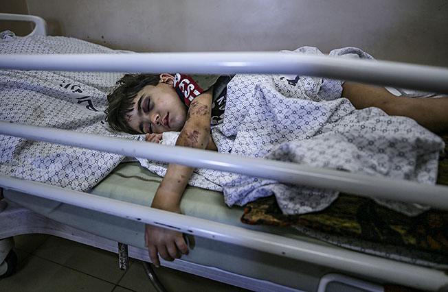 在加萨希法医院，一名受伤男孩虚弱地躺在病床上。（欧新社）