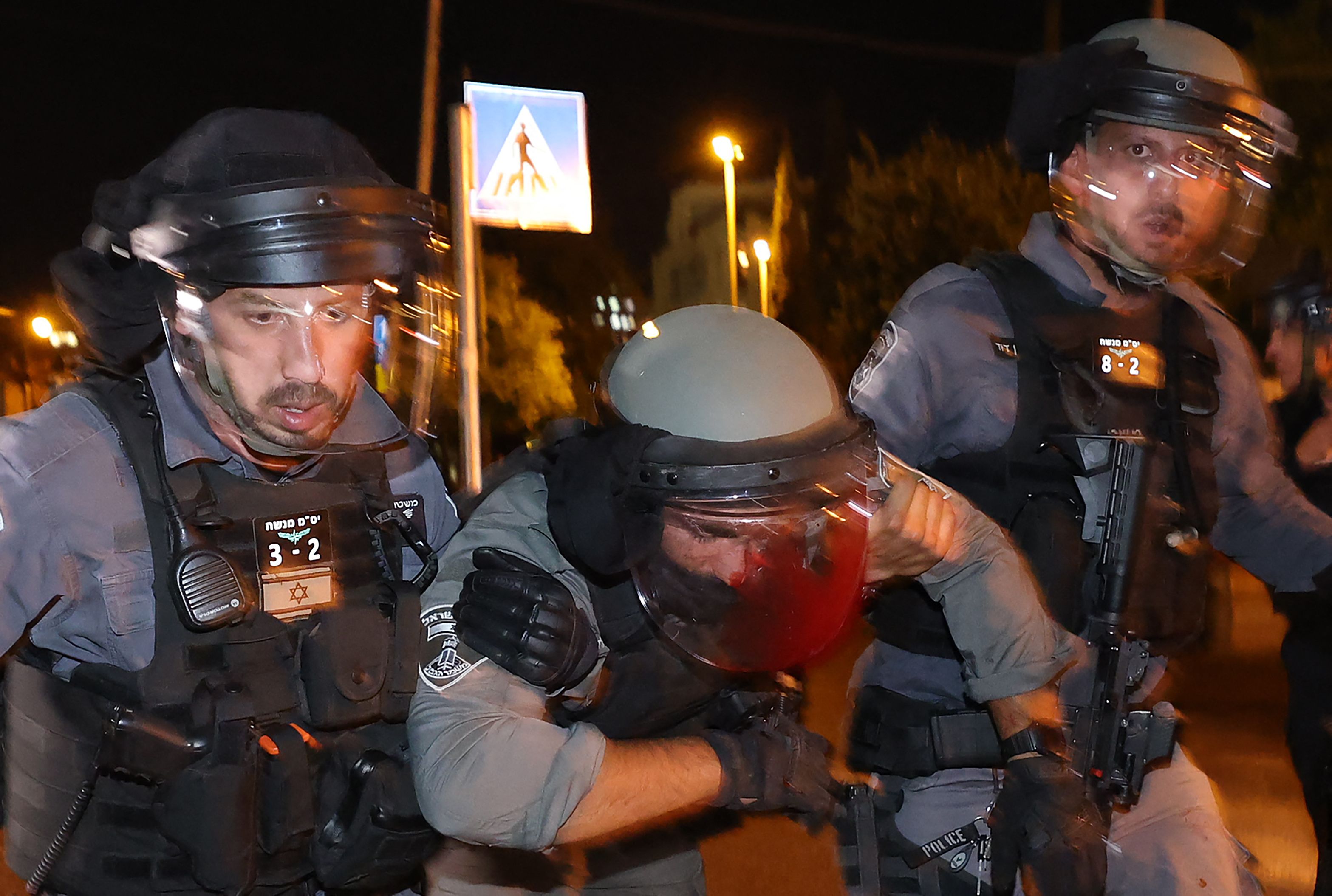 其中一名以色列警员受伤，血流满面。（法新社）