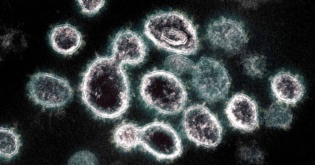 澳洲葛瑞菲斯大学孟席斯健康研究所宣布开发出抗病毒药物，能消灭体内99.9％的新型冠状病毒。