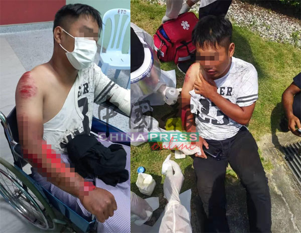 华裔送货员的手臂和肩膀严重受伤。（图事主提供）
