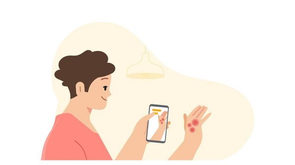 ▲谷歌在稍早举办的I/O活动上，揭露了一款能够协助判断皮肤状况的医疗App，预计年底前推出。