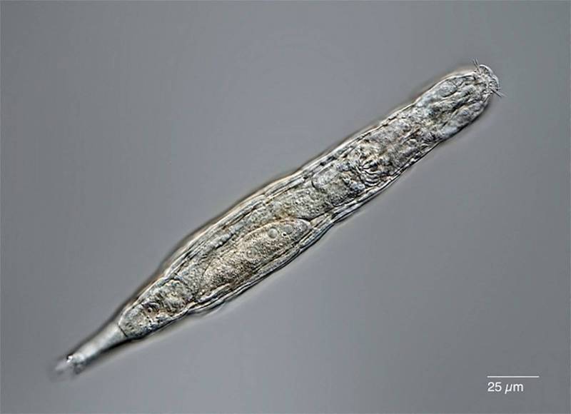 在俄罗斯西伯利亚北极地区冰冻约2.4万年的多细胞生物蛭形轮虫，目前已成功解冻复活。（法新社）