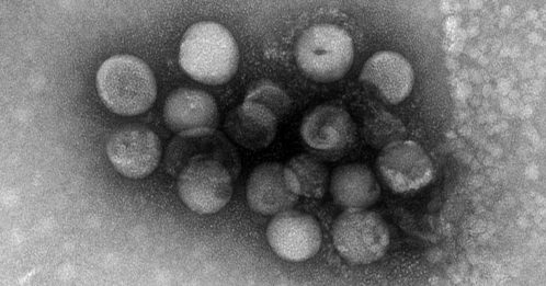 ◤全球大流行◢ 科学家：2种冠状病毒 动物传人 其中一种出现在大马