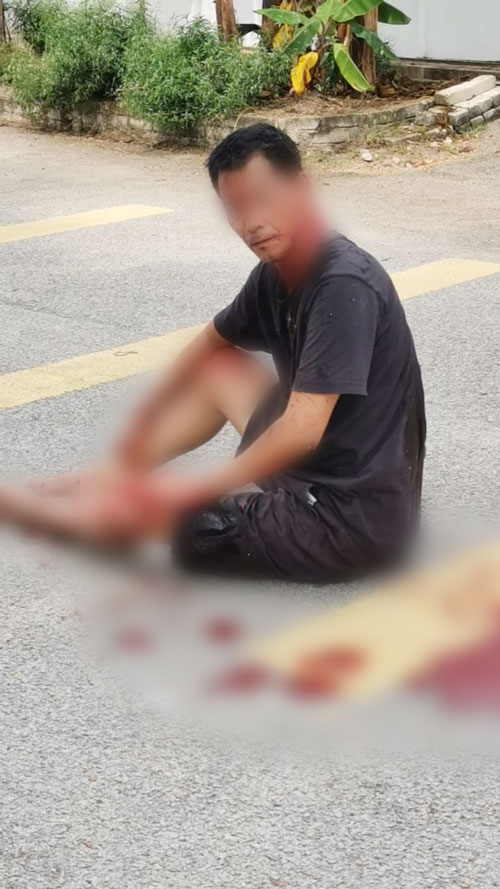 男子被砍伤后，一脸茫然的坐在地上。