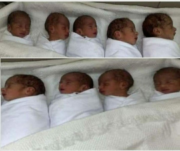 9胞胎每2小时需喂一次奶。