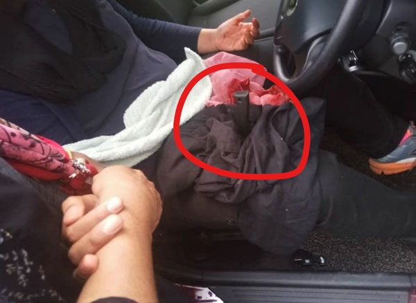 女子大腿被刺入刀子，导致她无法开车追匪和求助。