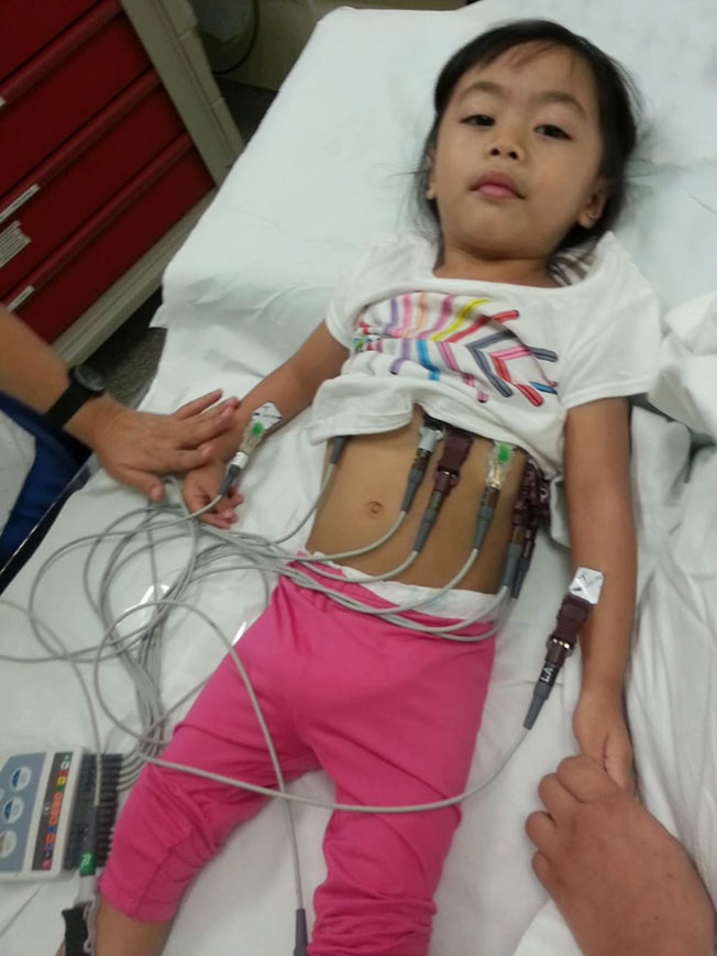 六岁的珍妮尔患有先天性心脏疾病，必须动手术安装心脏起搏器，降低心脏骤停的风险。（受访者提供）