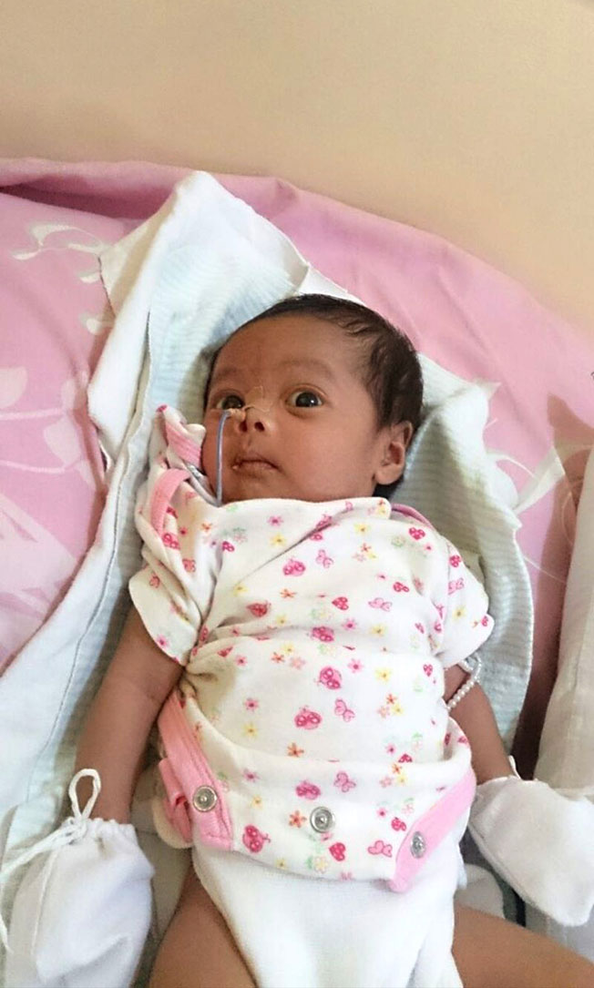 珍妮尔出生时在新生儿重症监护室待了两周，得通过鼻胃管灌食（NGT）。（受访者提供）