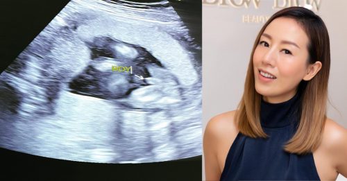 梁靖琪宣布第二胎怀儿子
