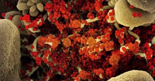 ◤全球大流行◢史丹佛大学报告 Omicron跟HIV病毒有关