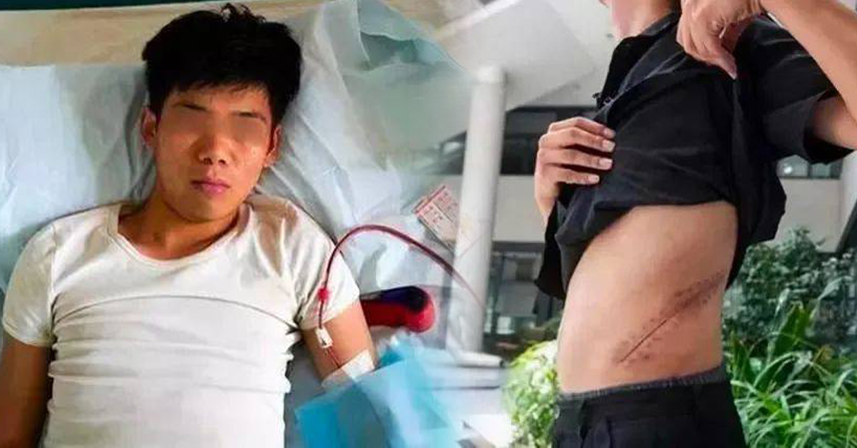 中国安徽王男10年前卖肾买iPhone,下场是需要长期洗肾。