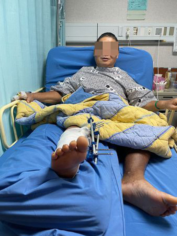 　黄男30年内，被撞伤逾10次，最近徒步时又挨撞住院。