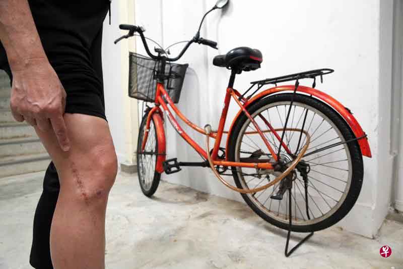 陈晓萍展示其伤疤；后为她在事发时骑的脚车。