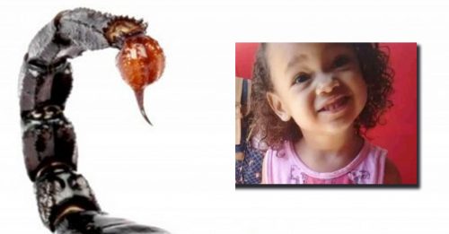 毒蝎连螫2次 4岁女童中毒亡