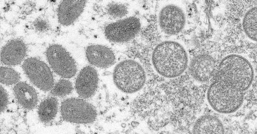 ◤猴痘来袭◢ “猴痘传染力达4周” 专家：夏季加速传播