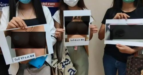 隆胸后乳房不对称 20位泰女报警！