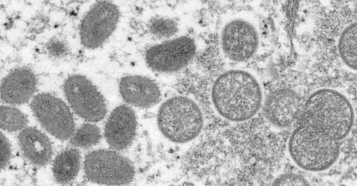 ◤猴痘來襲◢ 非洲以外猴痘最大疫區 英國累計574人感染