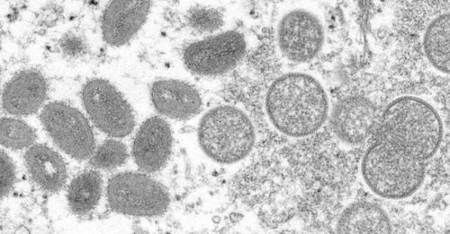 ◤猴痘来袭◢ 意大利研究曝光 精液恐是猴痘传染媒介