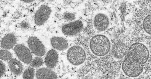 美国加强应对猴痘  未来数周分发近30万疫苗