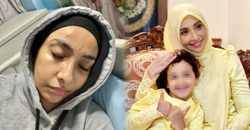 马来女星被袭击 4岁女险遭绑架