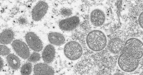 ◤猴痘来袭◢ 再多8国现首例 猴痘变异比预期快12倍