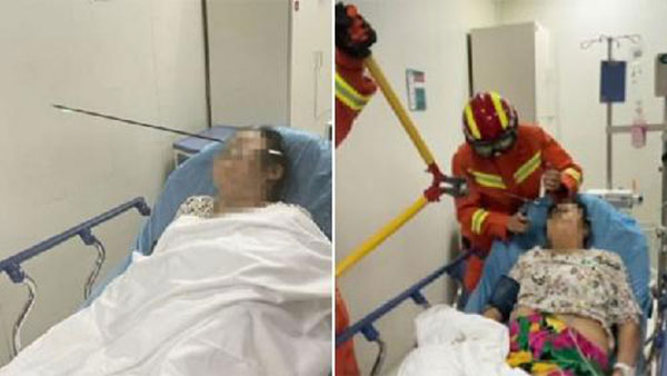 被弓箭射穿脸部的大妈，紧急送院治疗，消防救援人员将弓箭剪断。