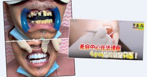 假牙医只顾赚钱 设备未消毒可传病