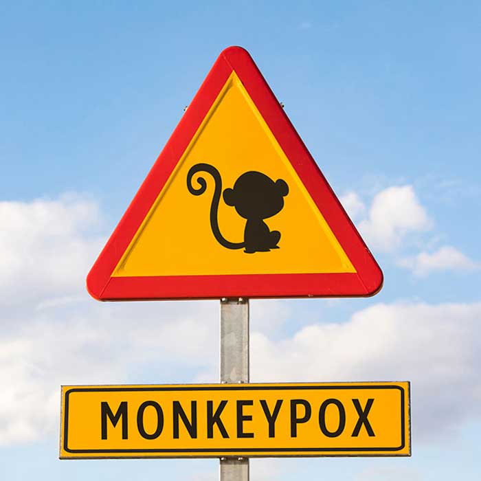 monkeypox, 猴痘