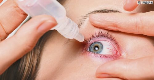 ◤健康百科◢防治干眼症 勿只靠人工泪液