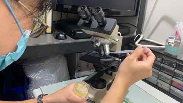 苏信豪医生取男子的精液，准备在显微镜下进行观察。