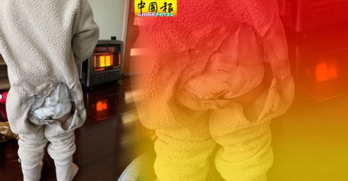 站暖炉前30秒烧掉睡衣 2岁男童险被火焚身