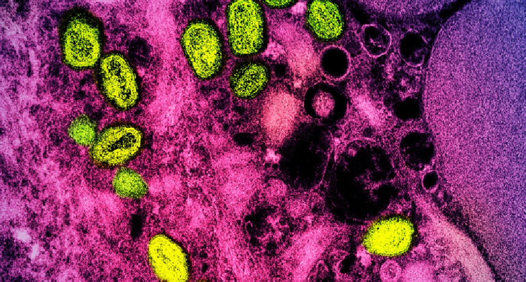 受感染细胞中的猴痘病毒（绿色）。