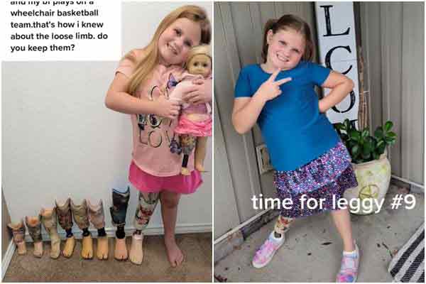 7岁女童搭乘游乐设施“飞天秋千”，义肢却突然故障喷飞。