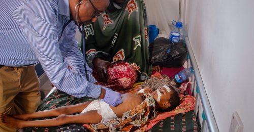 索马里20万人濒临饥荒 营养中心730儿童死亡