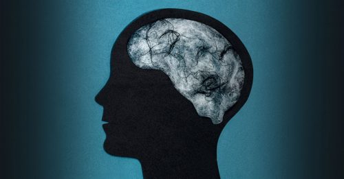 ◤全球大流行◢ 研究：新冠肺炎伤脑筋 确诊者脑雾风险 高77%！