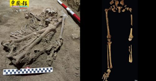 史前外科手术 3.1万年前