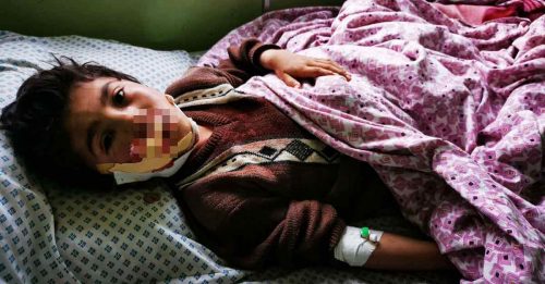 阿富汗学校爆炸  16死24伤