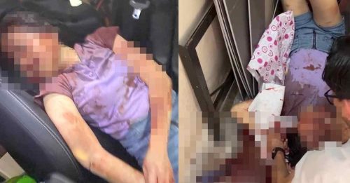 疑被亏空公款员工打劫痛殴 37岁华裔女东主 重伤昏迷