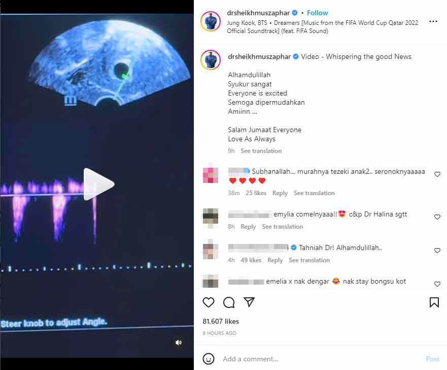 赛慕斯扎法在视频尾声展示超声波和胎儿心电图的画面，寓意其第7名孩子的到来。（取自赛慕斯扎法Instagram）