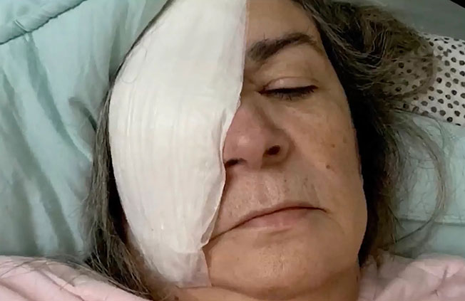 佛州老妇奥利瓦（图）用EzriCare眼药水后丧失右眼球。