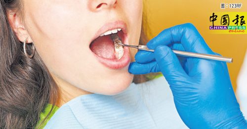 ◤健康百科◢ 洗牙损坏牙齿是世纪大误会