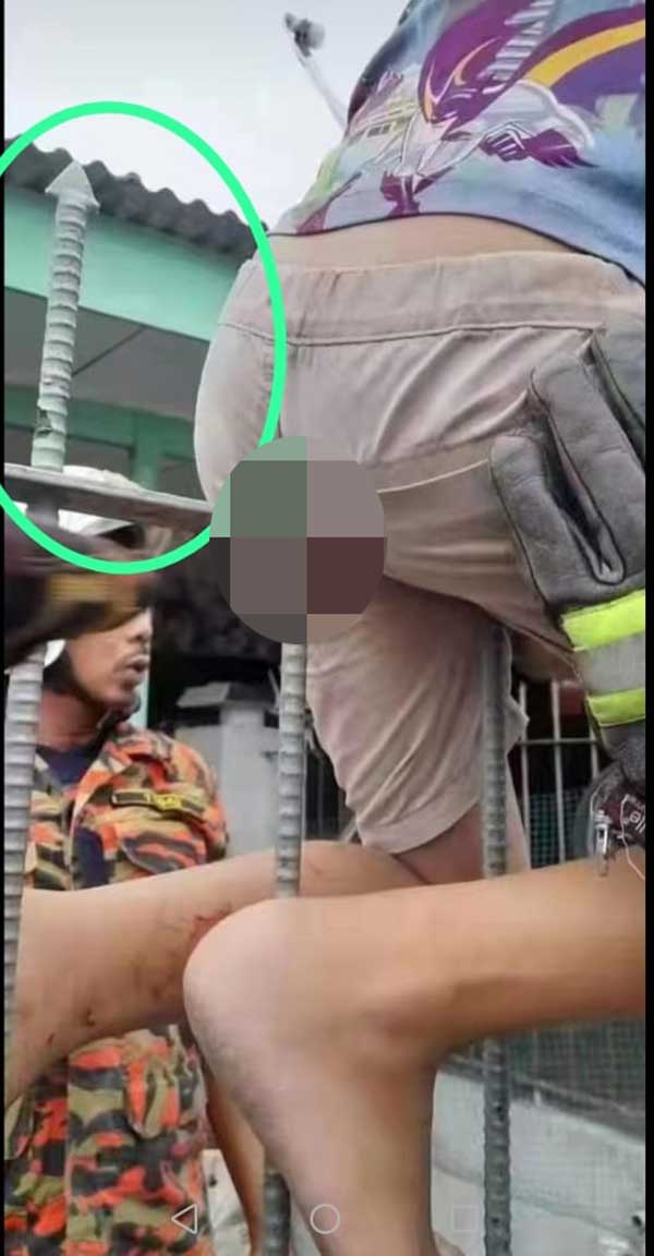 boy hurt 篱笆 屁股