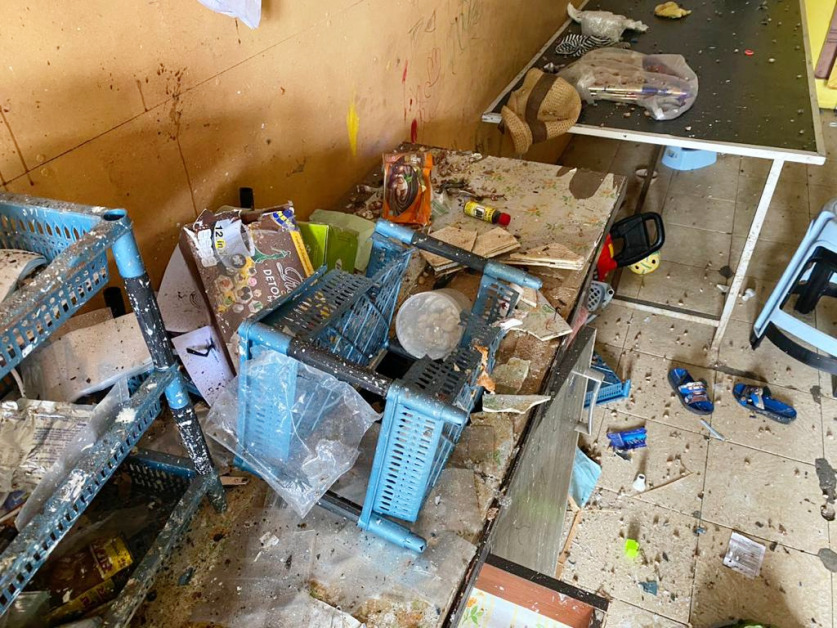 包裹一开就爆炸 女子被炸伤脸和身体