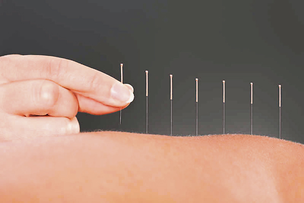 中医在郁证方面重要是心理辅导，然后才到中药和针炙，中药通过辨症改善其内环境，针炙疏通经络。